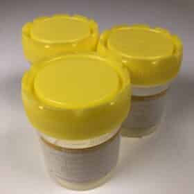 Sterile Culture Jars - 3 Pack